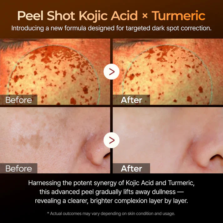 Radiance Peel Shot Spray - Dark Spot Corrector & Glow Booster
